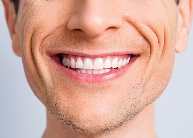 Man smiling with white teeth