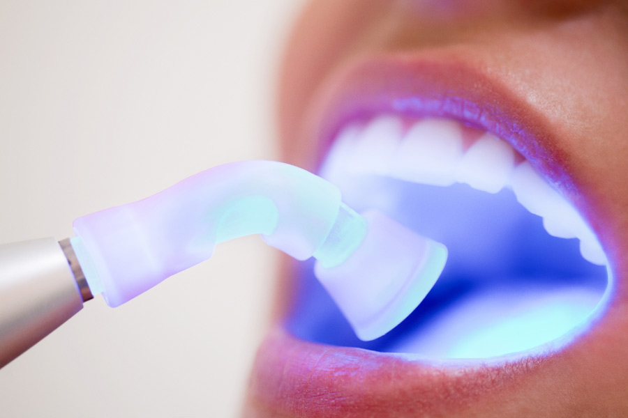 Special light that detects oral cancer is shown into a dental patient's mouth.