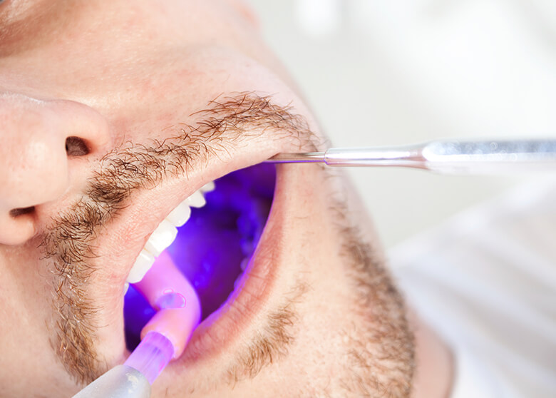 closeup of a man having his mouth examined for cancer