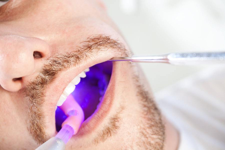 Man at the dentist being checked for oral cancer.