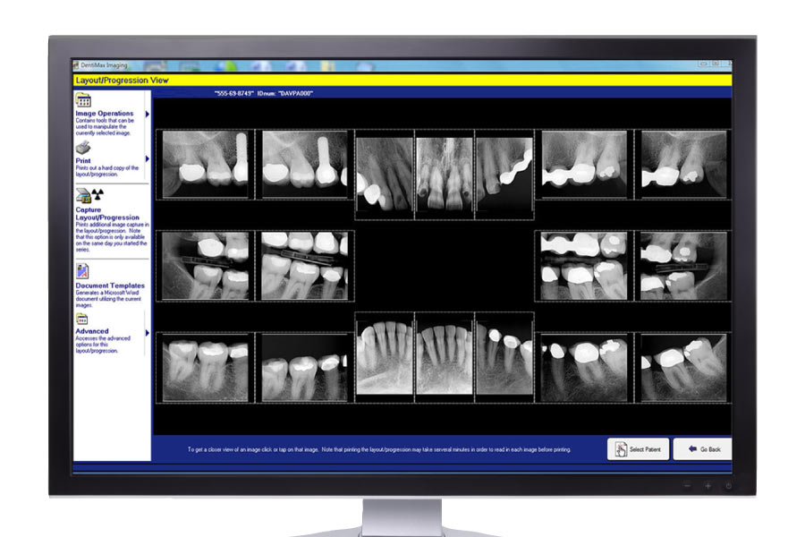 Screen showing a digital X-ray.